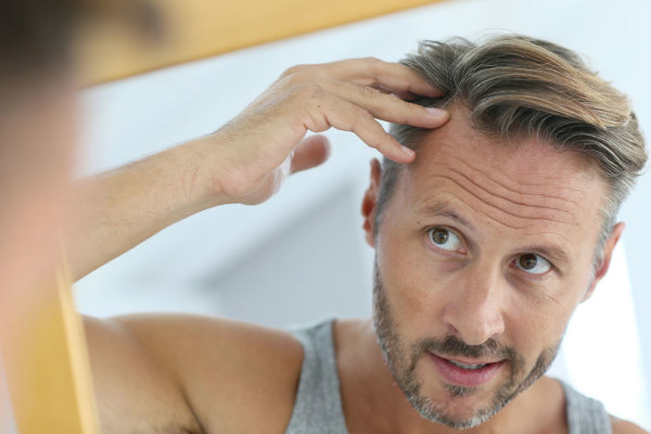 Erkeklerde Saç Dökülmesi